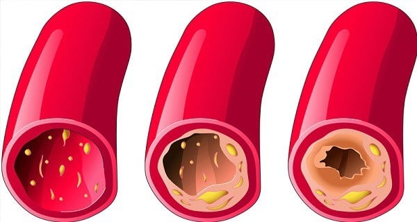 10_aliments_qui_débouchent_vos-01.jpg